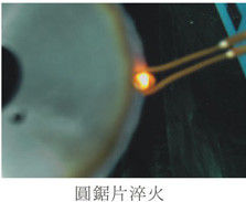 تجهیزات ذوب کردن با فرکانس فوق العاده بالا 1-2Mhz